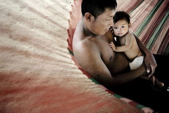 Fotografía: Mads Nissen/MSF