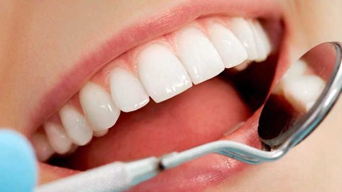 Nanopartículas combaten deterioro dental