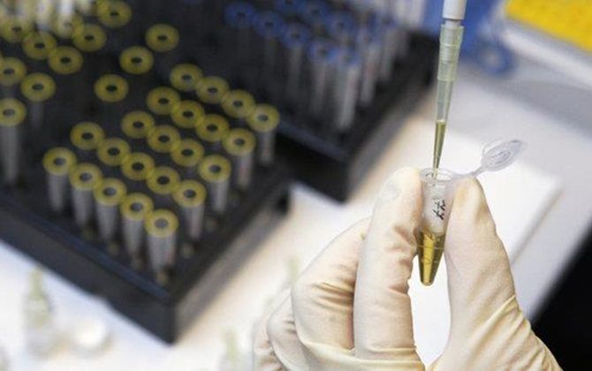 Vacuna experimental contra el virus del ébola inicia pruebas con humanos