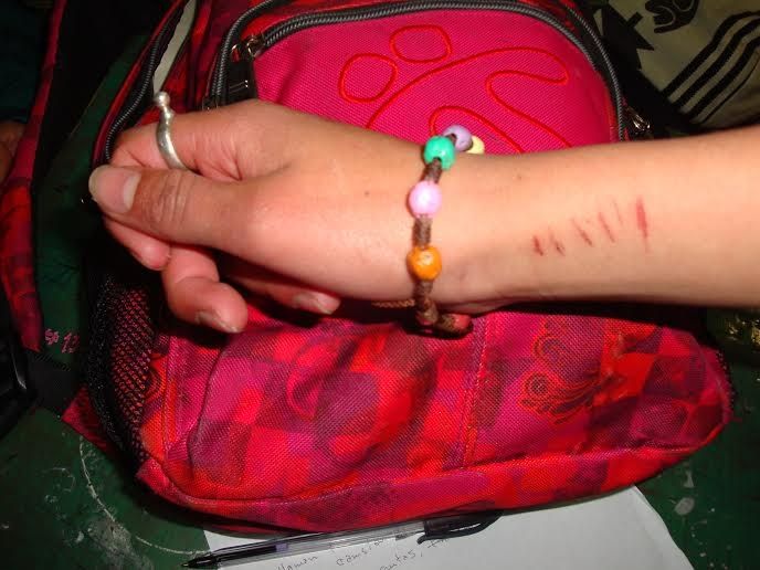 Intentos de suicidio: tendencia en los colegios de Pasto
