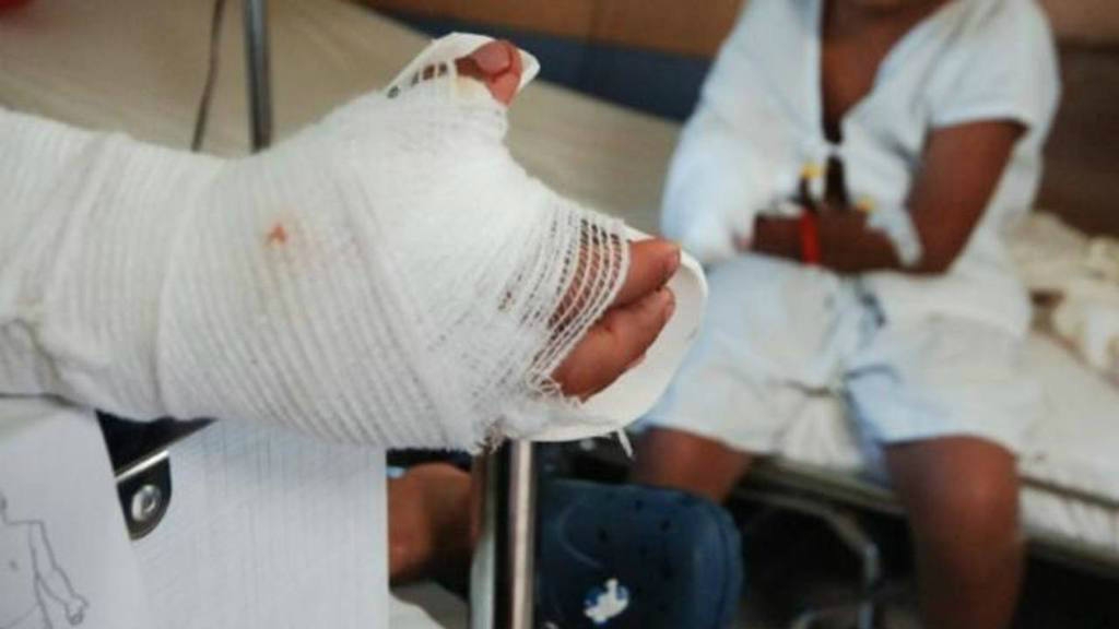En Nariño 72 personas lesionadas con pólvora